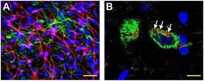 Facilitation of Gastrointestinal (GI) Tract Microbiome-Derived Lipopolysaccharide (LPS) Entry Into Human Neurons by Amyloid Beta-42 (Aβ42) Peptide